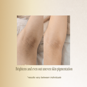 OPT Skin Whitening Underarm Spa Treatment