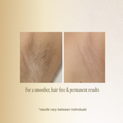 OPT Brazilian Hair Removal